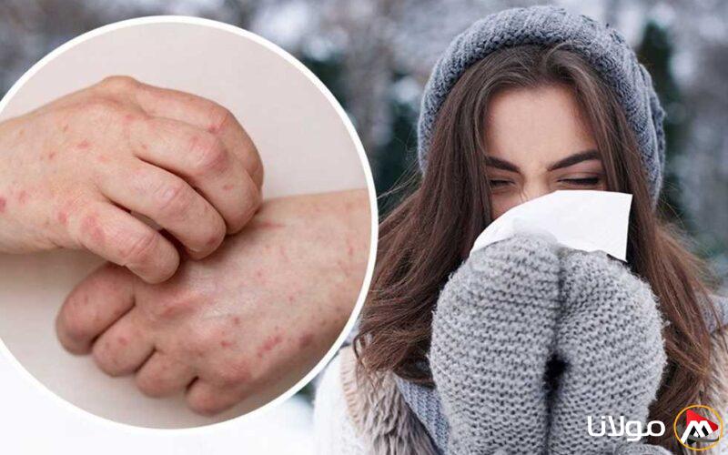 كيف تحمي نفسك من نزلات البرد خلال تغيرات الفصول والطقس؟ إليك 7 نصائح فعالة