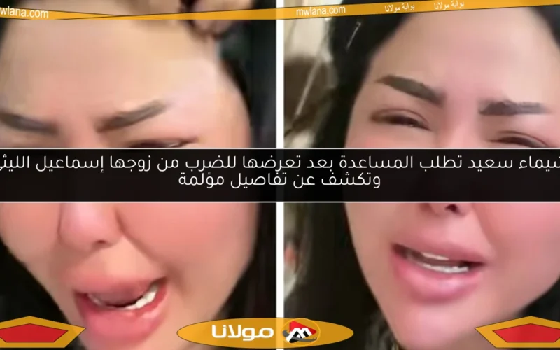 شيماء سعيد تطلب المساعدة بعد تعرضها للضرب من زوجها إسماعيل الليثي وتكشف عن تفاصيل مؤلمة