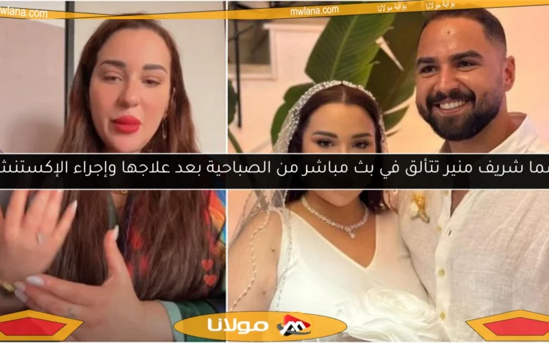 أسما شريف منير تتألق في بث مباشر من الصباحية بعد علاجها وإجراء الإكستنشن