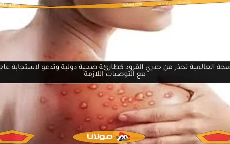 الصحة العالمية تحذر من جدري القرود كطارئة صحية دولية وتدعو لاستجابة عاجلة مع التوصيات اللازمة
