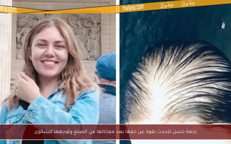 رحمة حسن تتحدث بقوة عن حقها بعد معاناتها من الصلع وتوجهها للشكوى