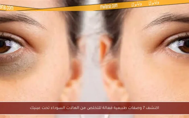 اكتشف 7 وصفات طبيعية فعالة للتخلص من الهالات السوداء تحت عينيك
